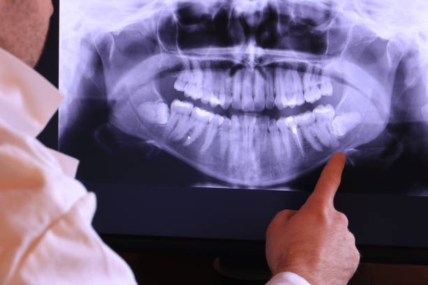 Best Cosmetic Emergency Dentistry in Wilton Manors, FL